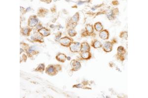 anti-CCR4-NOT Transcription Complex, Subunit 3 (CNOT3) (AA 525-575) antibody