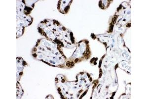 Immunohistochemistry (IHC) image for anti-Proteasome (Prosome, Macropain) 26S Subunit, Non-ATPase, 14 (PSMD14) (AA 362-632) antibody (ABIN3032352)