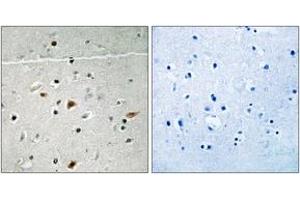 Immunohistochemistry analysis of paraffin-embedded human brain, using LIMK2 (Phospho-Ser283) Antibody. (LIMK2 抗体  (pSer283))