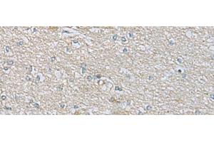 Immunohistochemistry of paraffin-embedded Human brain tissue using CDH12 Polyclonal Antibody at dilution of 1:60(x200) (Cadherin 12 抗体)