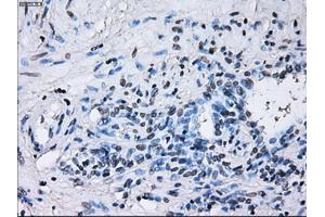 Immunohistochemical staining of paraffin-embedded Ovary tissue using anti-RNF144Bmouse monoclonal antibody. (RNF144B 抗体  (AA 1-256))