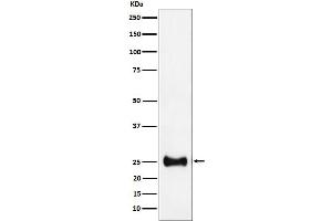 Western blot analysis of Adenylate kinase 4 expression in HepG2 cell lysate. (Recombinant AK4 抗体)