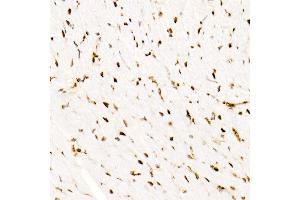 Immunohistochemistry (IHC) image for anti-SWI/SNF Related, Matrix Associated, Actin Dependent Regulator of Chromatin, Subfamily B, Member 1 (SMARCB1) antibody (ABIN7270657)