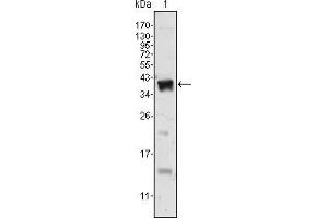 Western blot analysis using Androgen receptor mAb against human Androgen receptor (AA: 221-321) recombinant protein. (Androgen Receptor 抗体)