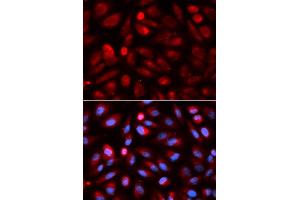 Immunofluorescence analysis of U2OS cell using ACP5 antibody. (ACP5 抗体  (AA 76-325))