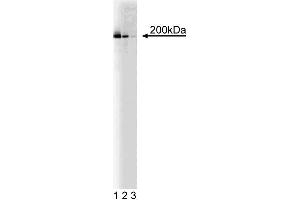 Western blot of analysis of KIF1A on a rat embryonic (E21) cerebrum lysate.