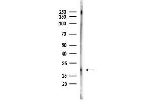 Western blot analysis of lysates from LoVo cells(heat-shock,45 min treatment), using CLEC4A Antibody at 1/1000 dilution.