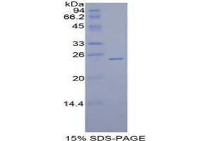 SDS-PAGE analysis of Human Sprouty Homolog 1 Protein. (SPRY1 蛋白)