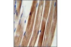 Immunohistochemistry (Paraffin-embedded Sections) (IHC (p)) image for anti-KAT8 Regulatory NSL Complex Subunit 3 (KANSL3) (AA 401-431), (Middle Region) antibody (ABIN953055)