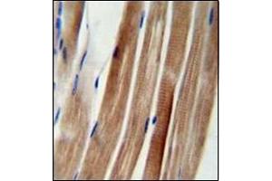 Immunohistochemistry analysis in formalin fixed and paraffin embedded human skeletal muscle reacted with KIAA1310 Antibody (Center) followed which was peroxidase conjugated to the secondary antibody and followed by DAB staining. (KANSL3 抗体  (Middle Region))