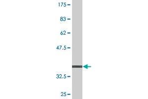 Western Blot detection against Immunogen (36. (PEX6 抗体  (AA 881-980))
