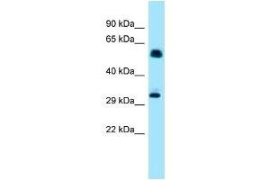Western Blotting (WB) image for anti-Inositol Hexakisphosphate Kinase 1 (IP6K1) (N-Term) antibody (ABIN2789109) (IP6K1 抗体  (N-Term))
