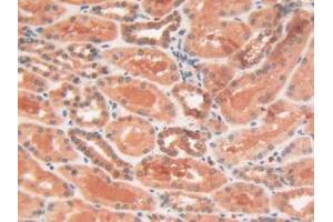 IHC-P analysis of Human Kidney Tissue, with DAB staining. (PYGL 抗体  (AA 370-538))