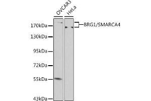 Western blot analysis of extracts of various cell lines, using BRG1/BRG1/SM antibody (ABIN6133730, ABIN6148100, ABIN6148101 and ABIN7101348) at 1:500 dilution. (SMARCA4 抗体  (AA 30-130))