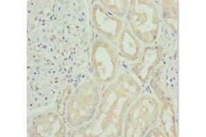 Immunohistochemistry of paraffin-embedded human kidney tissue using ABIN7171148 at dilution of 1:100 (SNAP29 抗体  (AA 1-258))