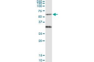 Immunoprecipitation (IP) image for anti-Protein Interacting With Protein Kinase C, alpha 1 (PICK1) (AA 1-415) antibody (ABIN522928)