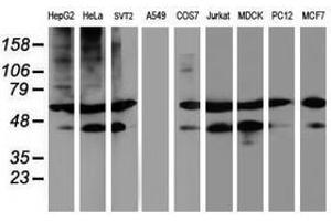 Image no. 2 for anti-Tubulin, alpha-Like 3 (TUBAL3) (AA 150-446) antibody (ABIN1490960) (TUBAL3 抗体  (AA 150-446))