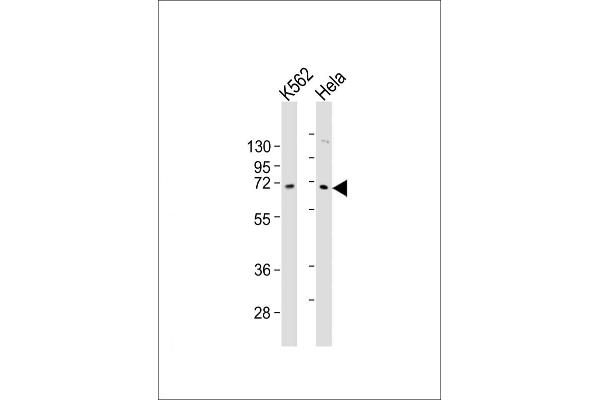 ZNF257 anticorps  (C-Term)