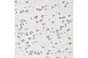 Immunohistochemistry of paraffin-embedded rat brain using COPB2 antibody (ABIN2561951) at dilution of 1:100 (40x lens). (COPB2 抗体)