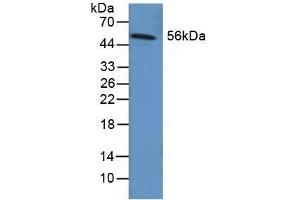 Detection of FGB in Human Liver Tissue using Polyclonal Antibody to Fibrinogen Beta Chain (FGB) (Fibrinogen beta Chain 抗体  (AA 29-118))