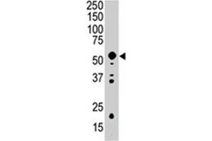 Western blot analysis of PDK2 polyclonal antibody  in mouse intestine tissue lysate (35 ug/lane). (PDK2 抗体  (AA 378-407))