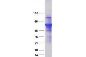 Western Blotting (WB) image for Atlastin GTPase 3 (ATL3) protein (Myc-DYKDDDDK Tag) (ABIN2715028)
