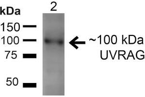 Western blot analysis of Rat Liver showing detection of ~100kDa UVRAG protein using Rabbit Anti-UVRAG Polyclonal Antibody . (UVRAG 抗体  (HRP))