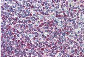 Immunohistochemistry (Formalin-fixed Paraffin-embedded Sections) (IHC (fp)) image for anti-ATPase, Ca++ Transporting, Ubiquitous (ATP2A3) (AA 501-621) antibody (ABIN790453)