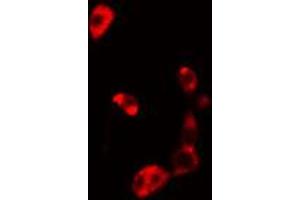 ABIN6274830 staining HuvEc cells by IF/ICC. (AKR1B1 抗体  (C-Term))