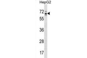Western Blotting (WB) image for anti-rho GTPase Activating Protein 36 (ARHGAP36) antibody (ABIN2998590) (ARHGAP36 抗体)