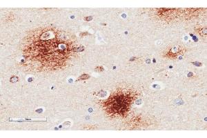 Immunohistochemical staining of human Alzheimer's disease hippocampus tissue using anti-Amyloid Beta antibody. (Recombinant beta Amyloid 抗体)