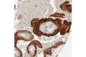 Immunohistochemical staining of human placenta with LETM2 polyclonal antibody  shows strong cytoplasmic positivity in trophoblastic cells at 1:200-1:500 dilution. (LETM2 抗体)