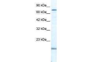 WB Suggested Anti-PGBD3 Antibody Titration:  2. (PGBD3 抗体  (N-Term))