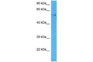 Host:  Mouse  Target Name:  HSF2  Sample Tissue:  Mouse Testis  Antibody Dilution:  1ug/ml (HSF2 抗体  (Middle Region))