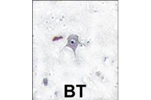 Formalin-fixed and paraffin-embedded human brain tissue reacted with PIK3R2 Antibody (N-term) Ap8028a , which was peroxidase-conjugated to the secondary antibody, followed by DAB staining. (PIK3R2 抗体  (N-Term))