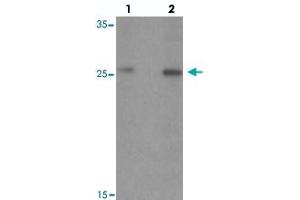 Western blot analysis of PTPRD in HeLa cell lysate with PTPRD polyclonal antibody  at (lane 1) 1 and (lane 2) 2 ug/mL. (PTPRD 抗体  (N-Term))