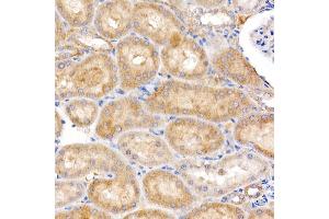 Immunohistochemistry of paraffin-embedded rat kidney using MT-ND4 Rabbit pAb (ABIN7268602) at dilution of 1:250 (40x lens). (Mitochondrially Encoded NADH Dehydrogenase 4 (MT-ND4) 抗体)