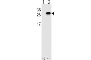 Western Blotting (WB) image for anti-Interleukin 28B (Interferon, lambda 3) (IL28B) antibody (ABIN2999039) (IL28B 抗体)