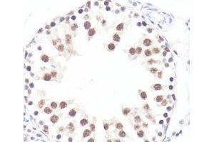 Immunohistochemistry of paraffin-embedded Rat testis using Phospho-MYC(S62) Polyclonal Antibody at dilution of 1:100 (40x lens). (c-MYC 抗体  (pSer62))