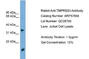 WB Suggested Anti-TMPRSS3  Antibody Titration: 0. (TMPRSS3 抗体  (N-Term))