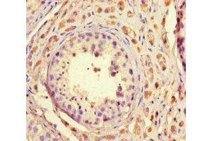 Immunohistochemistry of paraffin-embedded human testis tissue using ABIN7172681 at dilution of 1:100