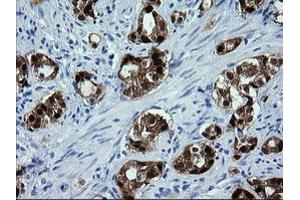 Image no. 1 for anti-Cytidine Monophosphate (UMP-CMP) Kinase 1, Cytosolic (CMPK1) antibody (ABIN1497545) (Cytidine Monophosphate (UMP-CMP) Kinase 1, Cytosolic (CMPK1) 抗体)