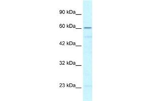 WB Suggested Anti-ZNF212 Antibody Titration:  0. (ZNF212 抗体  (N-Term))