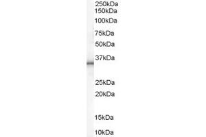 ABIN185512 (1 ug/ml) staining of Human Adipose lysate (35 ug protein in RIPA buffer). (UCP1 抗体  (C-Term))