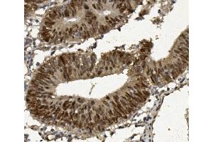 IHC analysis of FOXP1 using anti-FOXP1 antibody (ABIN7602780). (FOXP1 抗体  (C-Term))