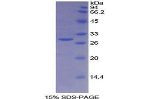 SDS-PAGE analysis of Human BRCA2 Protein. (BRCA2 蛋白)