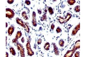 Formalin-fixed, paraffin-embedded human breast carcinoma stained with TFF1 antibody. (TFF1 抗体  (C-Term))