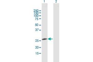 Western Blot analysis of GOSR2 expression in transfected 293T cell line by GOSR2 MaxPab polyclonal antibody. (GOSR2 抗体  (AA 1-213))