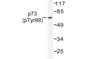 Image no. 1 for anti-Tumor Protein P73 (TP73) (pTyr99) antibody (ABIN318099)