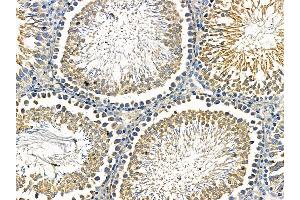 ABIN7095536 and ABIN7099593 at 1/100 staining rat testis tissue by IHC-P. (FBXO4 抗体)